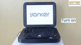 YONKER PU-DL151A Portable Ultrasound Machine