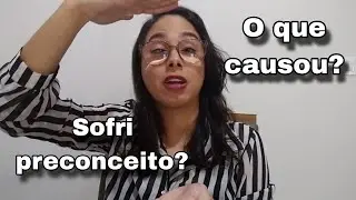 MINHA DEFICIÊNCIA VISUAL: Respondendo perguntas frequentes sobre a baixa visão - Ruana Sertão