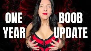 1 YEAR BREAST AUGMENTATION UPDATE | PHOTOS AND FOLLOW UP #breastaugmentationsurgery #plasticsurgery