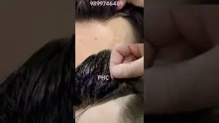 Skin Base Hair Patch System🔥| 100% Natural Look #hairreplacement #hairsystem