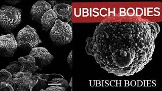 [12th] Ubisch bodies and Pollenkitt @kppoints3192