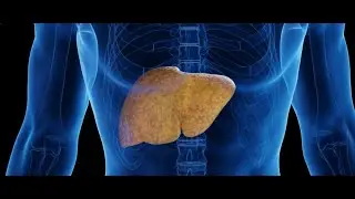 How to Reverse Fatty Liver  Fast! The Ultimate Natural Cure for NAFLD (Non- Alcoholic Fatty Liver)