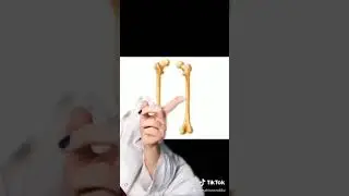 Osteoporosis