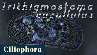 A cyrtophorid ciliate Trithigmostoma cucullulus (Ciliophora)