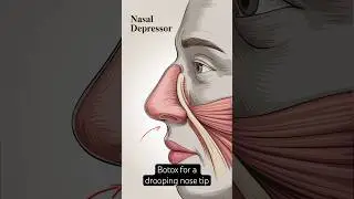 Botox for a drooping nose tip 💉👃🏼