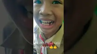 Tips Cabut gigi Aman buat anak