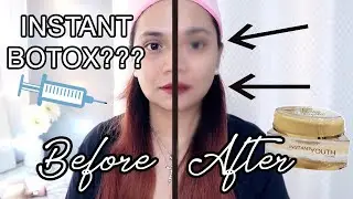 DIY BOTOX? Valentus Instant Youth (Look younger in seconds!)