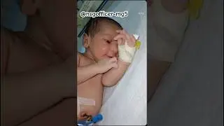 😴cute preterm baby #shortsfeed#babygirl  #medicalprocedure #cute #baby #newborn #viral #shorts