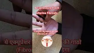 Uterus में रसौली या गांठ को दूर करने के लिए रोजाना 5 मिनट दबाए ये Acupressure Point ||