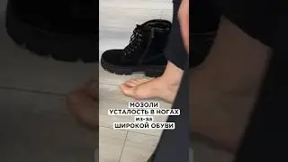 Мозоли, натёртости на стопе появляются из-за широкой обуви #мозоли #плоскостопие #стельки  #варикоз
