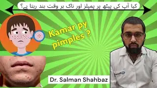 Dr.Salman - Which Vitamin Deficiency is Causing Your Back Acne & Sinus Issues?