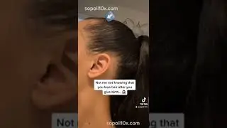 Vegamour review www.sopoli10x.com #vegamour #hairlosssolution #haircare #beautytips #hairtransform