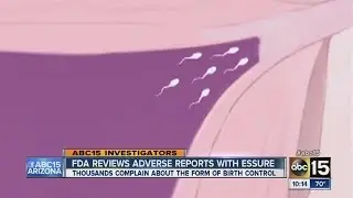 FDA reviewing complaints over Essure