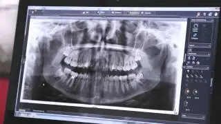The Best of Sirona Orthophos SL