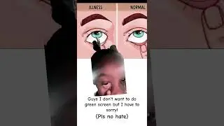 Pls no hate #eyecheck