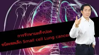มะเร็งปอดชนิดเซลเล็ก Small cell lung cancer โดย นพ.นรินทร์ วรวุฒิ
