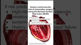 Assess cardiovascular risk of noncardiac surgery using the Revised Cardiac Risk Index (RCRI)