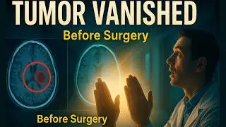 Tumor Vanishes Before Surgery - Doctors Stunned by Prayer Miracle | Celestial Counselor