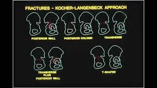 26  Miller's Orthopaedic Lectures  Trauma 2