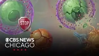 Northwestern Medicine trialing new antibody therapy in fight against pancreatic cancer