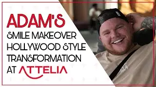 ADAM&rsquo;S SMILE MAKEOVER: HOLLYWOOD STYLE TRANSFORMATION!