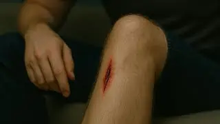 When Wounds Don&rsquo;t Heal&hellip; Something&rsquo;s Still Alive  #MedicalHorror #BodyHorror #TrueStories #Infection 