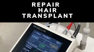 Repair Hair Transplant Explanation