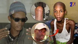 Samba Yoro &agrave; C&oelig;ur Ouvert : sa maladie - kalifone sall - l'argent cotis&eacute;...je suis millionnaire 