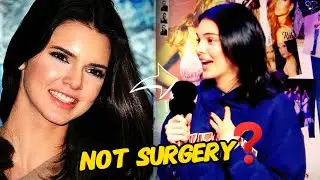 Kendall Jenner Finally Shuts Down Surgery Rumors!