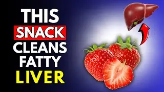 Top 7 Healthy Snacks That Support Liver Repair & Prevent Fatty Liver Naturally