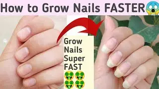 Grow Nails in 1 Week 😱| How to Grow Nails SUPER FAST | How to Whiten Nails | Long Nails Remedy