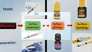keys to successful ceramic bonding