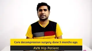 AVN Hip Core decompression surgery- Happy Patient Testimonial