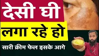 देसी घी For Pigmentation , best cream for pigmentation Dr Prateek chauhan