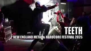 TEETH Live at NE Metal & Hardcore Fest 2025 | Ontario Hardcore/Metalcore Rupture