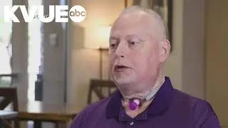 Massachusetts man receives total larynx transplant