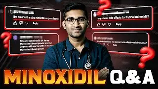 Minoxidil Q&A, Frequently Asked Questions & Answers! (தமிழ்) #tamil #hairloss #haircare #minoxidil