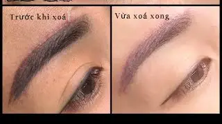 Xoá Lông Mày Bằng  Dung Dịch . Hướng Dẫn Cách Xoá Cơ Bản Dành Cho Các Bạn Mới Vào Nghề