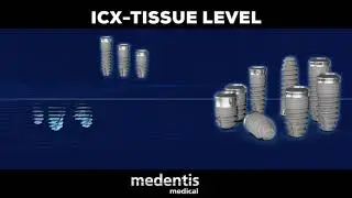 #ICX_Implant_System.