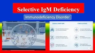 Селективный дефицит IgM &mdash; определение, типы, патофизиология, симптомы, диагностика, медицина