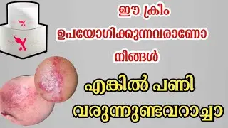 SKIN whitening cream review! Cream emirates skin whitening cream malayalam! Side effects #emirates 