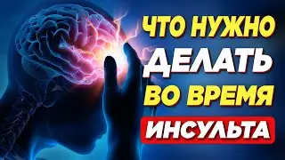 Первые признаки ИНСУЛЬТА! Что нужно делать во время ИНСУЛЬТА! (Важно знать каждому)