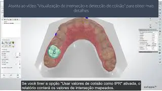 3Shape Clear Aligner Studio - IPR Reports BR PT