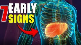 Optimize Your Liver Health: Top Signs of Liver Damage You Must Not Ignore