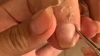Clean The Skin And Remove The Corner Of The Nail - Free Time With Nail #57