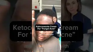 Ketoconazole Cream For &ldquo;Fungal Acne&rdquo; #dermreacts
