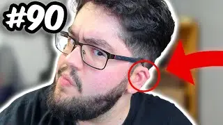 The REAL STORY of what happened to MY EAR?! [#90]
