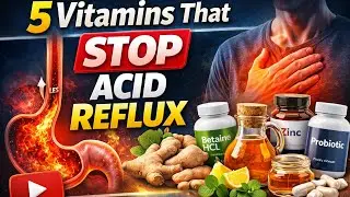 Top 5 Vitamins to Stop Acid Reflux Permanently