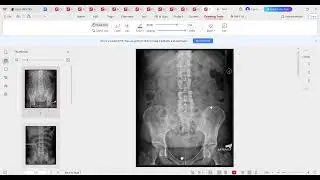 EMERGECNY RADIOLOGY OSCE SURGERY