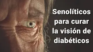 Senol&iacute;ticos para curar la visi&oacute;n de diab&eacute;ticos